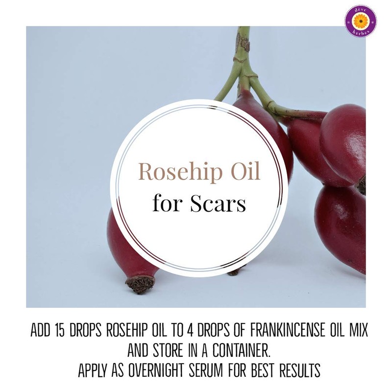 dève herbes Pure Rosehip Oil (Rosa rubiginosa) Cold Pressed 30ml