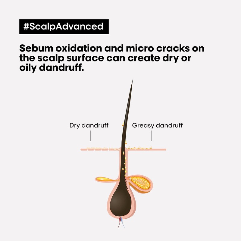 L'Oréal Professionnel Scalp Advanced Anti-Oiliness Duo Bundle