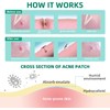 ACOTYE Anti Pimple Patch 210 Pieces Hydrocolloid Acne Pimple Patch