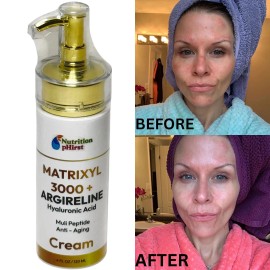 Nutrition pHirst Dark Skin Whitening Dark spot Brightening Bleaching Lightening Face body 3 pack