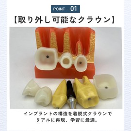 ideamall Implant Model Teeth Course Practice Model Educational Compact