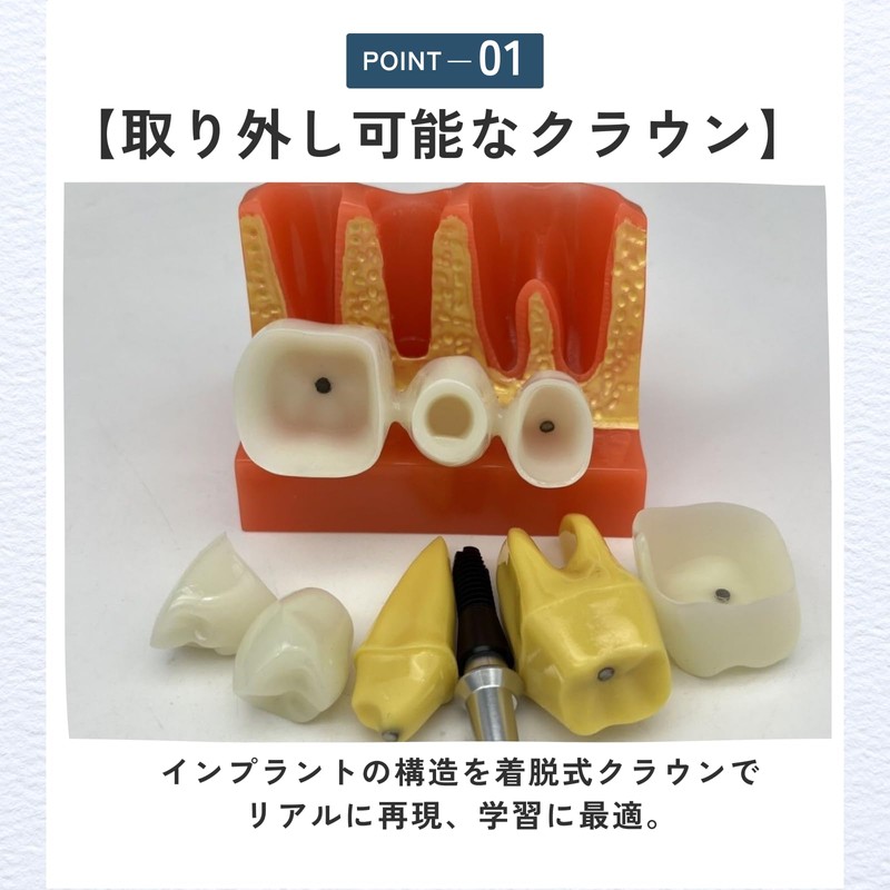 ideamall Implant Model Teeth Course Practice Model Educational Compact