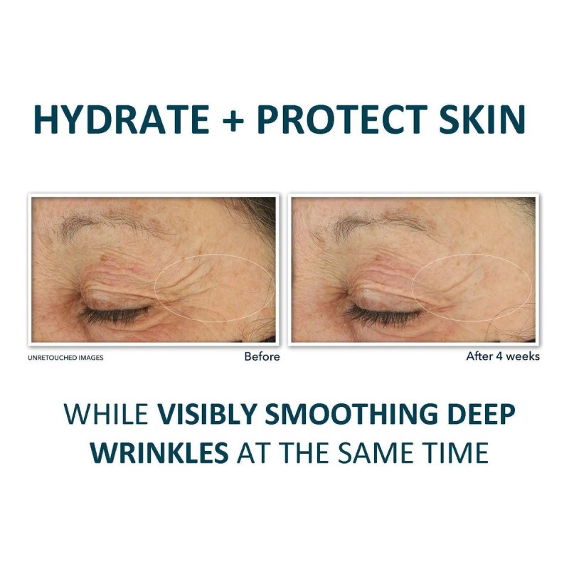 Correccin diaria de arrugas profundas con retinol Roc, SPF 30