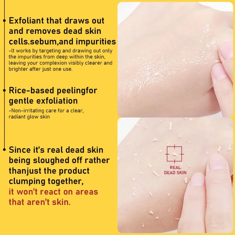 Phofay Sérum Exfoliación Niacinamida Ácido Tendencia Acnéica
