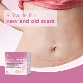 Professional Medical Silicone Scar Tape - Grade Scar Sheets, Non irritating, Painless for C-Section, Surgical Scars, Burn, Keloid, Acne, Provide Safe and Effective Solutions(1.6” x 60” Roll)