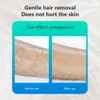 Portable Hair Remover Gentle Hair Removal without Shaving Hair Eraser
