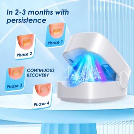 INCFADDY Nail Laser Fungus Device for Toenails & Fingernails,Home Use Nail Fungus Light Device for Onychomycosis,Nail Repair Solution for Damaged and Discolored Nails (White)