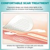 Extra Long Silicone Scar Sheets (1.6” x 200” Roll-5M), Silicone