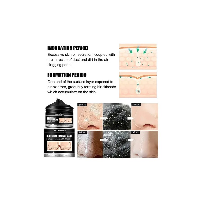 Mascarilla Puntos Negros Carbon De Bambu Limpieza Profunda