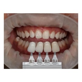 Resina Denta Zirconia Forma Ultradent Bl2 Blanco
