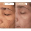 Crema Facial Hidratante Dermoaclaradora Reparadora Anti Acne Día/noche Todo Tipo