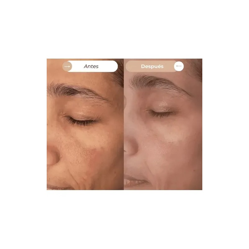 Crema Facial Hidratante Dermoaclaradora Reparadora Anti Acne Día/noche Todo Tipo