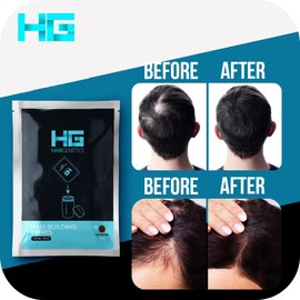 Hair Genetics Black Hair Fibres 22g Refill Pack (Black) for Hair Loss Treatment and Thinning Hair