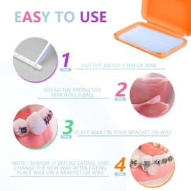 KISEER 12 unidades de cera dental ortodóntica para portadores de tirantes (10 aromas)
