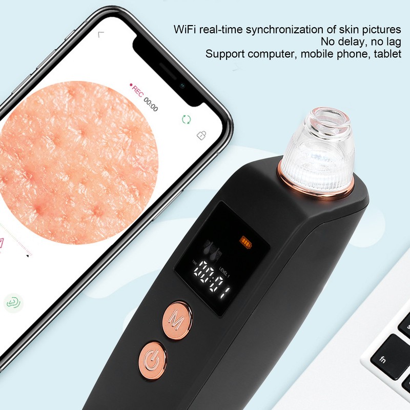 Visual Electric Blackhead Removal Machine Adjustable Vacuum Suction Face Pore