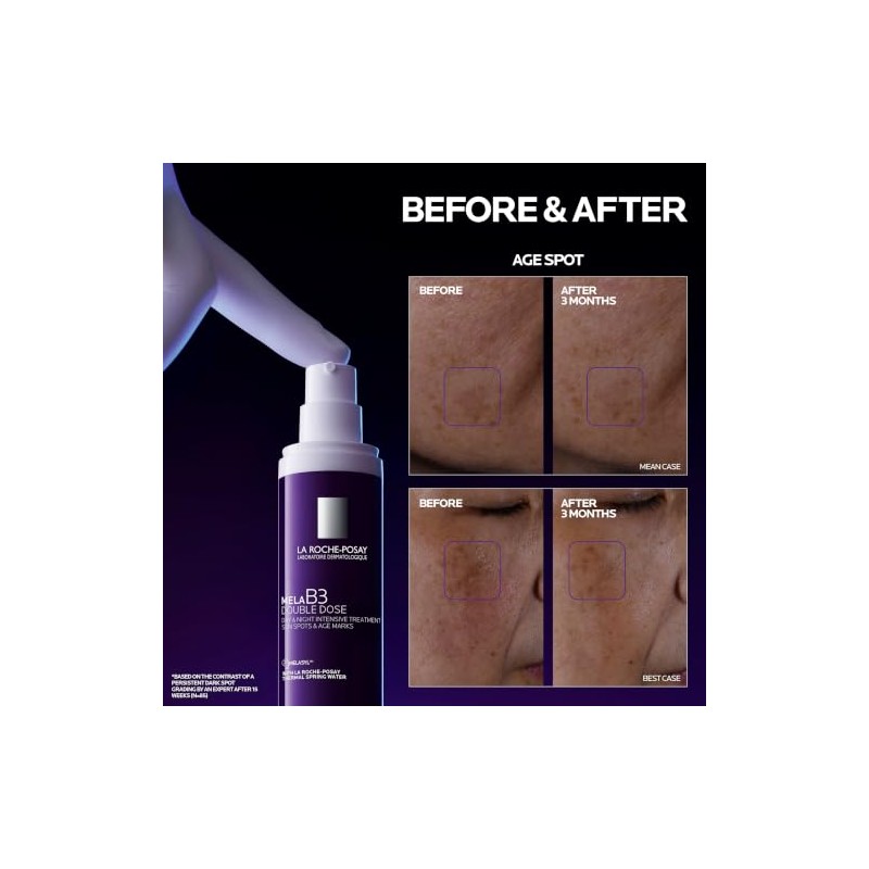 La Roche-Posay MELA B3 Double Dose Gel Crema Facial Anti-manchas