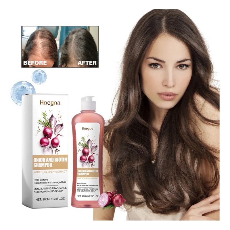 Champú De Cebolla Para El Crecimiento Del Cabello 200ml*2