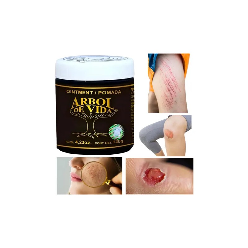 Pomada Tepezcohuite Árbol De Vida Natural Skin Cream, 120g