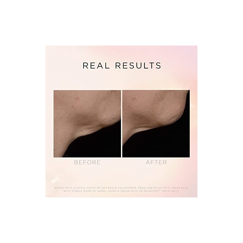 Cosmedix Illuminate Lift Neck Décolleté Treatment