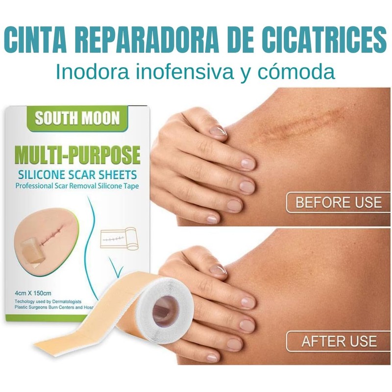 2 Rollos Cinta Silicona Reparación Cicatrices Marcas Piel Silicona Suave