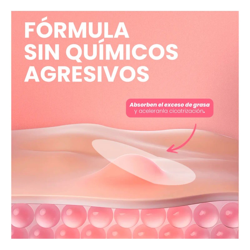 🔥 Parches para acné caja con 108 piezas absorben grasa