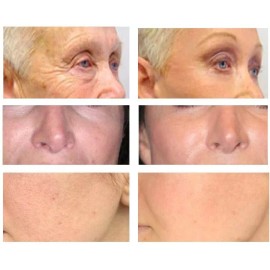 DERMA CLINICALS Retinol, Niacinamide, Vitamin C, Hyaluronic Acid, AntiAging Wrinkle SERUM - 4oz