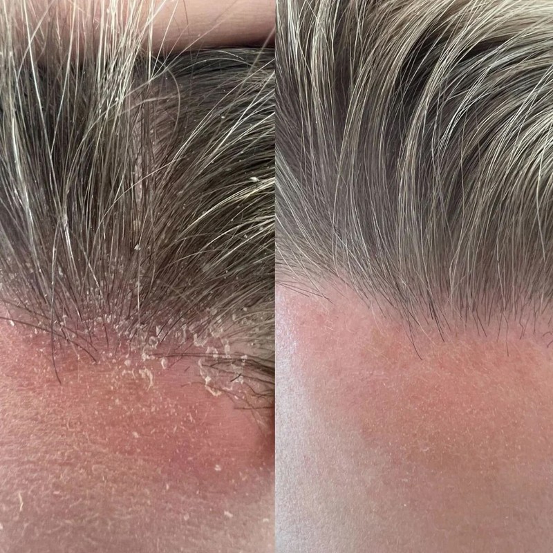 STRAAND Scalp Essential Trio Bundle