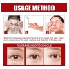/*remover De Milium, Sérum Para Milium En Rostro, Reduce Df