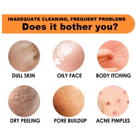 Intense Whitening Soap, Solid Soap, Natural and Organic Bar Soap, Solid Shower Gel, Natural Cosmetic, Shower Soap, Citrus Soap, Hands, Face, Body with Vitamin C, Hydrates the Skin