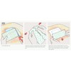 Mefix Self-Adhesive Fabric Tape, Dressing Fixation Fabric Tape, Secures Gauze,