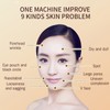 RF Radio Frequency Dot Matrix Face Tightening Rejuvenation Skin Beauty