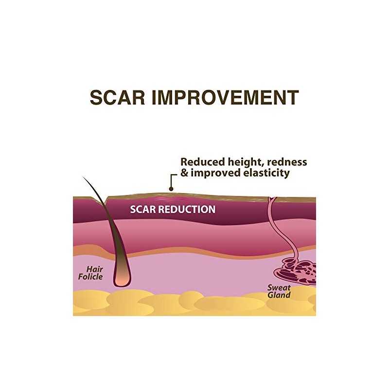 Scar Aid - Barra de silicona para tratamiento de cicatrices,