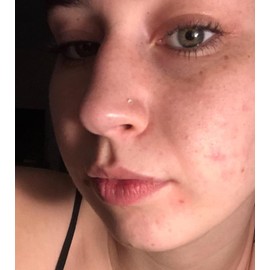 QWALIT Clear Nose Studs and Rings for Work - Plastic Retainer for Surgery - 18g Invisible Spacer - Small Stud