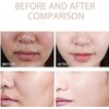 Gel exfoliante purificante - Limpiador facial - Gel exfoliante para