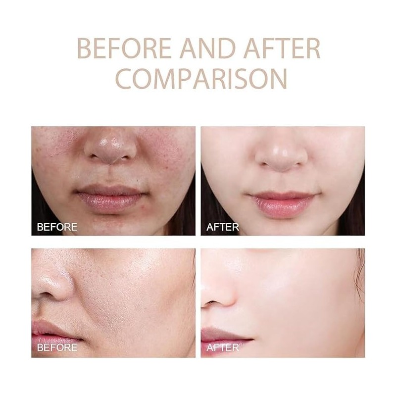 Gel exfoliante purificante - Limpiador facial - Gel exfoliante para