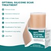 Silicone Scar Sheets (1.6"x 79" Roll-2M), Silicone Scar Tape for