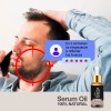3 Esencia Aceite Para Crecer Barba Bigote Natural 30ml C/u