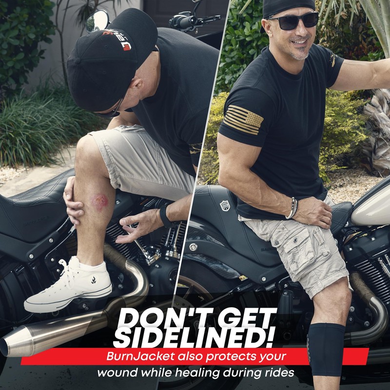 BurnJacket Motorcycle Exhaust Pipe Burn Protective Sleeve Leg Guard -