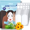 LitBear Large Pimple Patches, 168 Patches 5 Size, Acne Patches