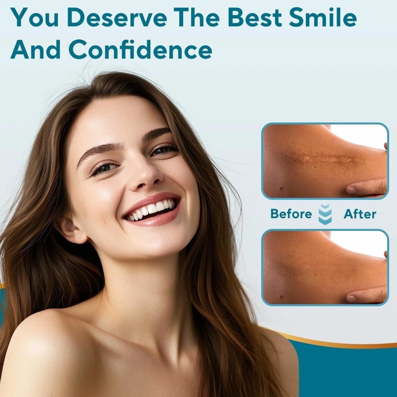 Invisible Silicone Scar Tape - Flexible, Reusable & Comfortable -