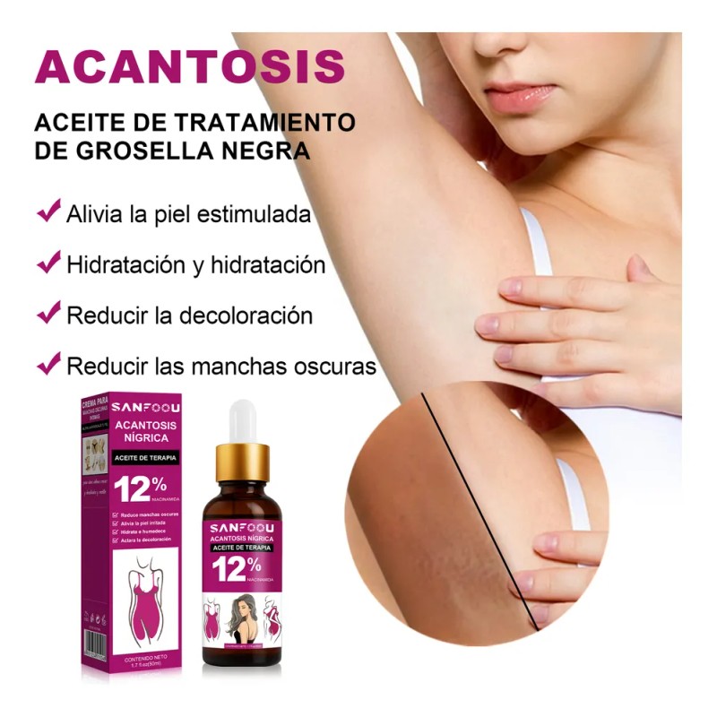 Aceite Acantosis Nigricans, Mejora La Hiperpigmentac Neutra