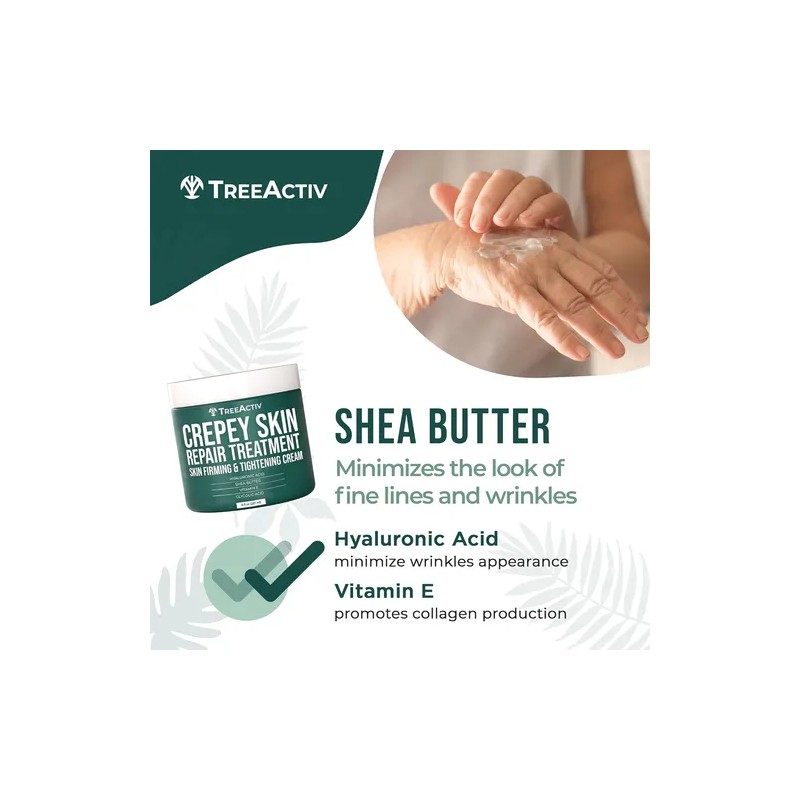 Treeactiv Crepey Skin Repair Treatment, 8oz, Crema Reafirman