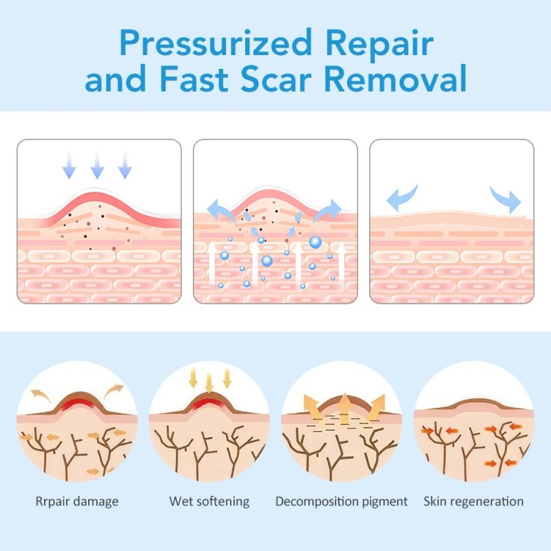 DERMFREE 6x Silicone Scar Sheets Gel Scar Patch Self-Adhesive Scar