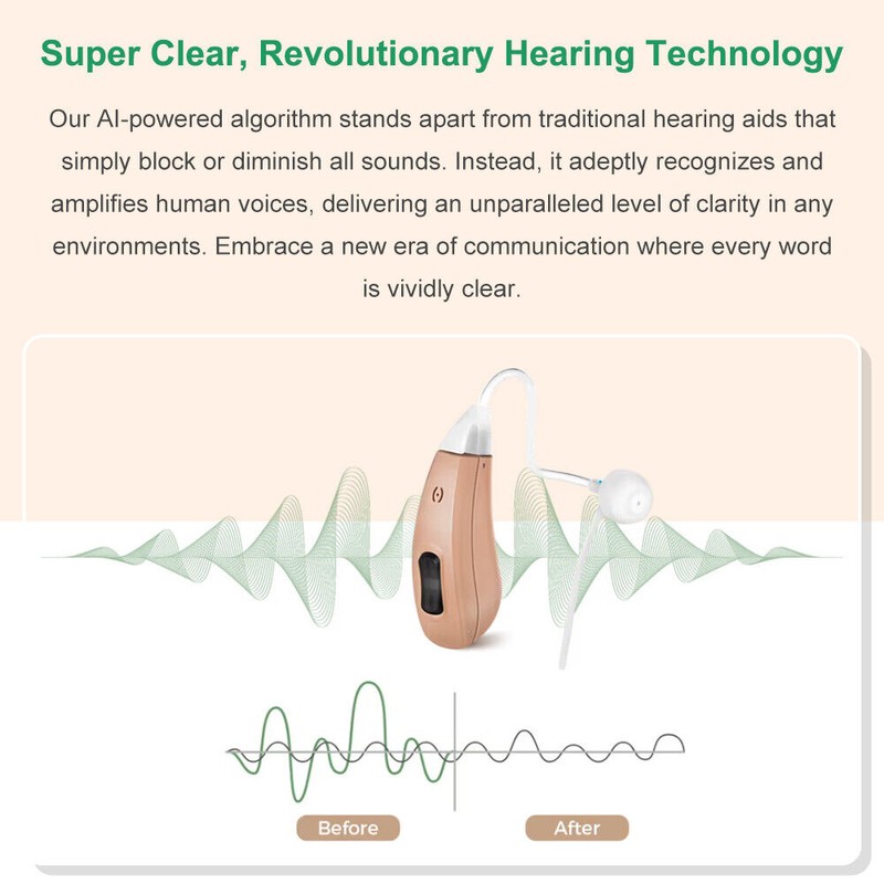 Unbranded Digital hearing Aids 250-5000Hz Automatic Noise Reduction and High-Quality
