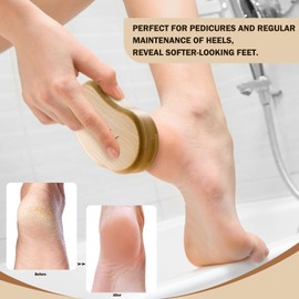 FVION Nano Glass Callus Remover, Callus Removal Foot, Callus Removal, Wet & Dry, Professional Callus File, Foot Care, Highly Effective Callus Rasp, Velvety Soft Feet