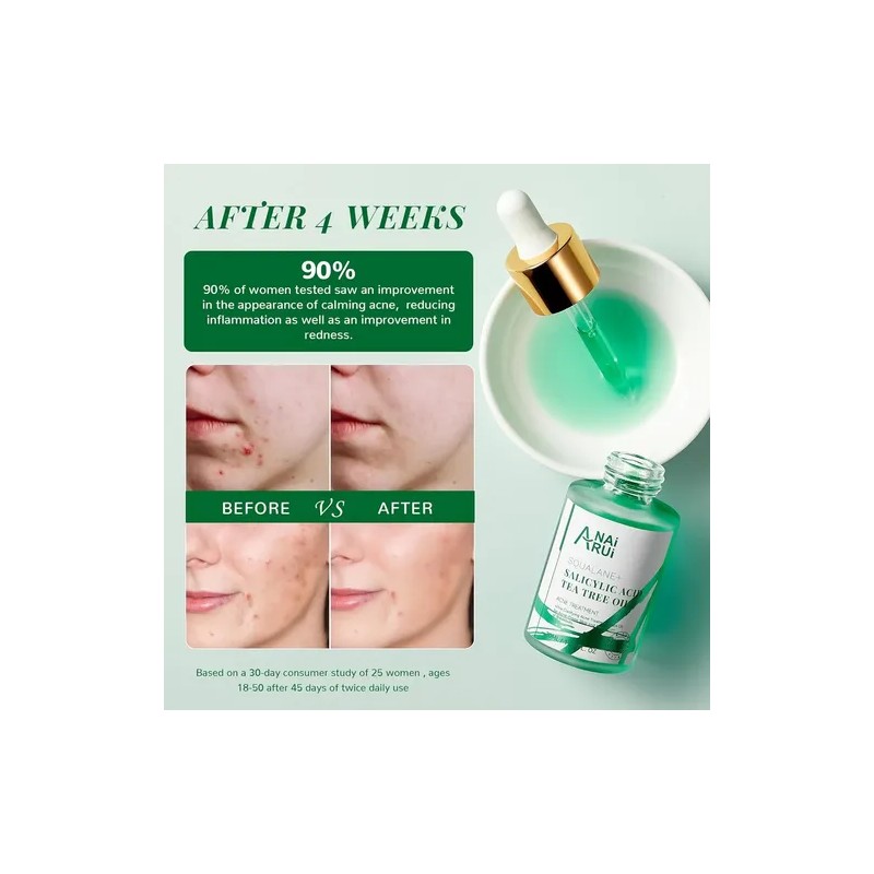 Aceite Facial Acne Anai Rui De Arbol De Te Acido