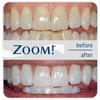New Zoom Nightwhite With ACP At Home Teeth Whitening Kit