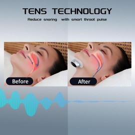 Anti Snoring Devices, Anti Snoring Device with Smart Throat Pulse, Electric Sleep Apnea Devices for Best Sleep,Comfortable Snoring Solution for Men and Women, Safe & Effective& Easy