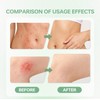 Intertrigo Relief Cream Crema hidratante protectora de la piel para