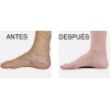 DOREAN Eliminador De Cicatrices Espinillas Estrias Y Varices